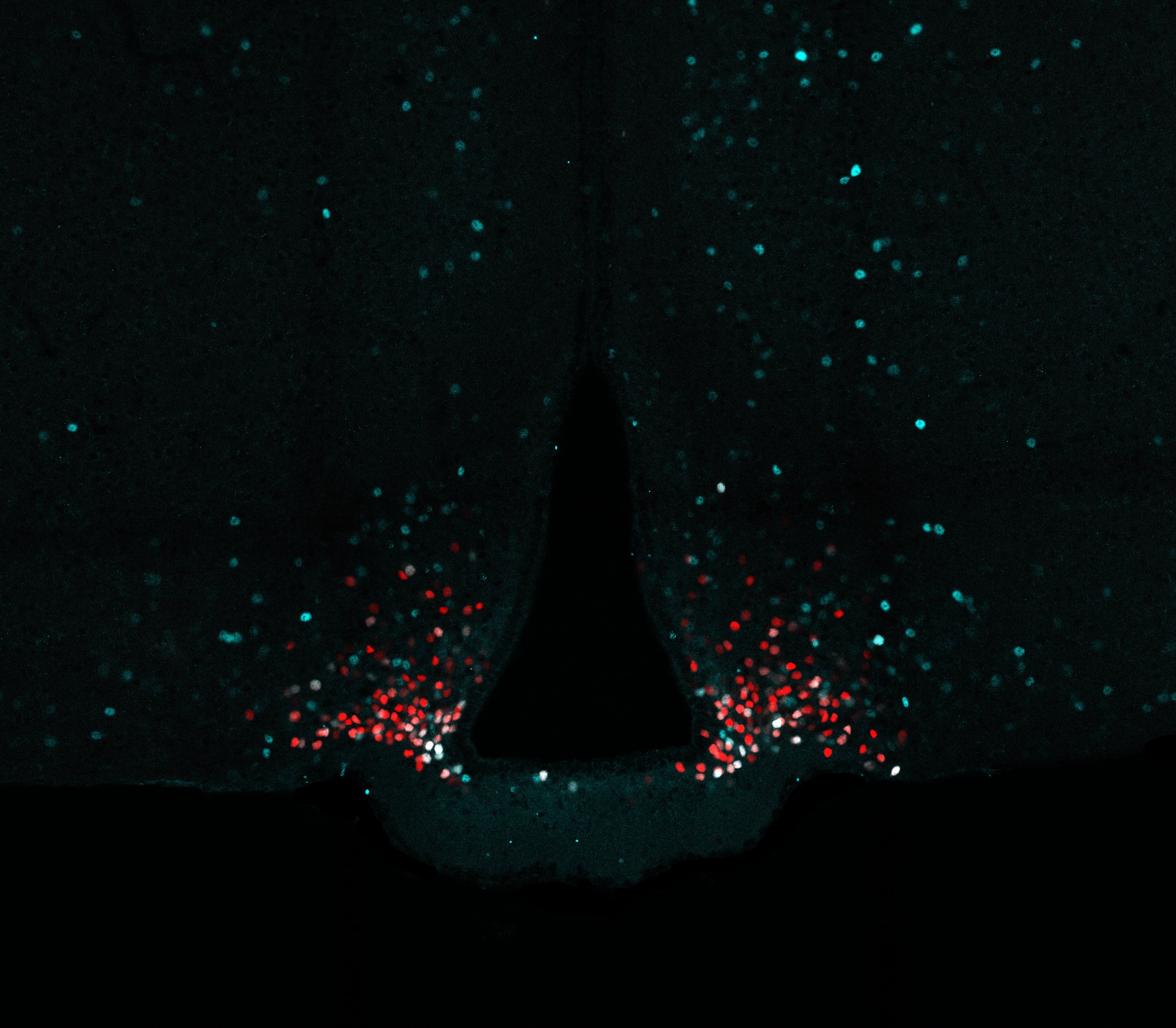 AgRP neurons (red) in the mouse hypothalamus around the third ventricle, with activity-labeled cells (white) after early-life social isolation.