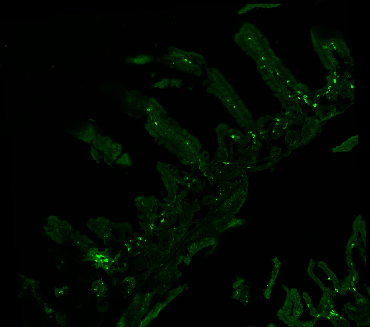 Fluorescent mast cells (green) studding the villi of the mouse small intestine, imaged in a mast-cell reporter mouse.